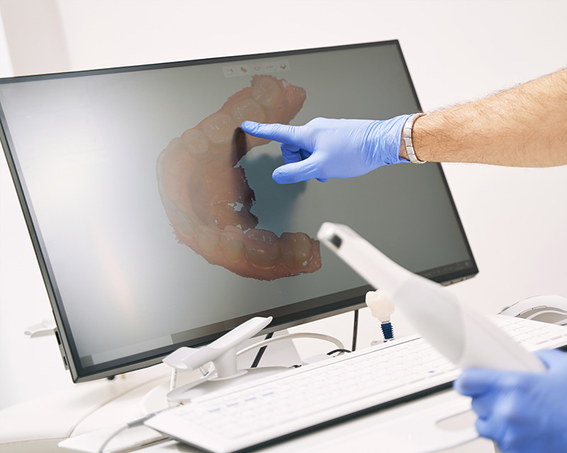 A person in a medical setting using a computer monitor to view a 3D model of a human mouth.
